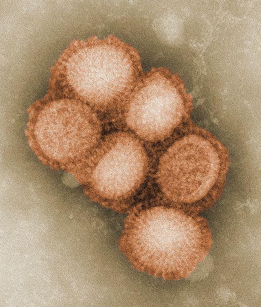 Вирус A/H1N1 под электронным микроскопом. Диаметр вируса — 80-120 нм. [1