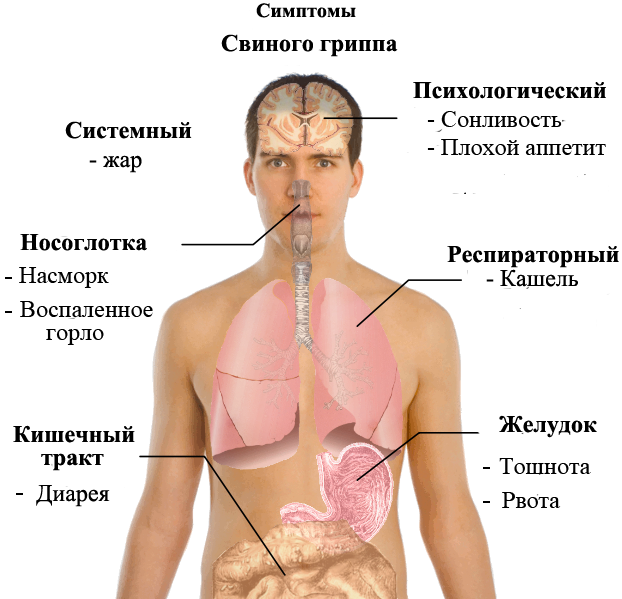 H1N1 основные симптомы болезни